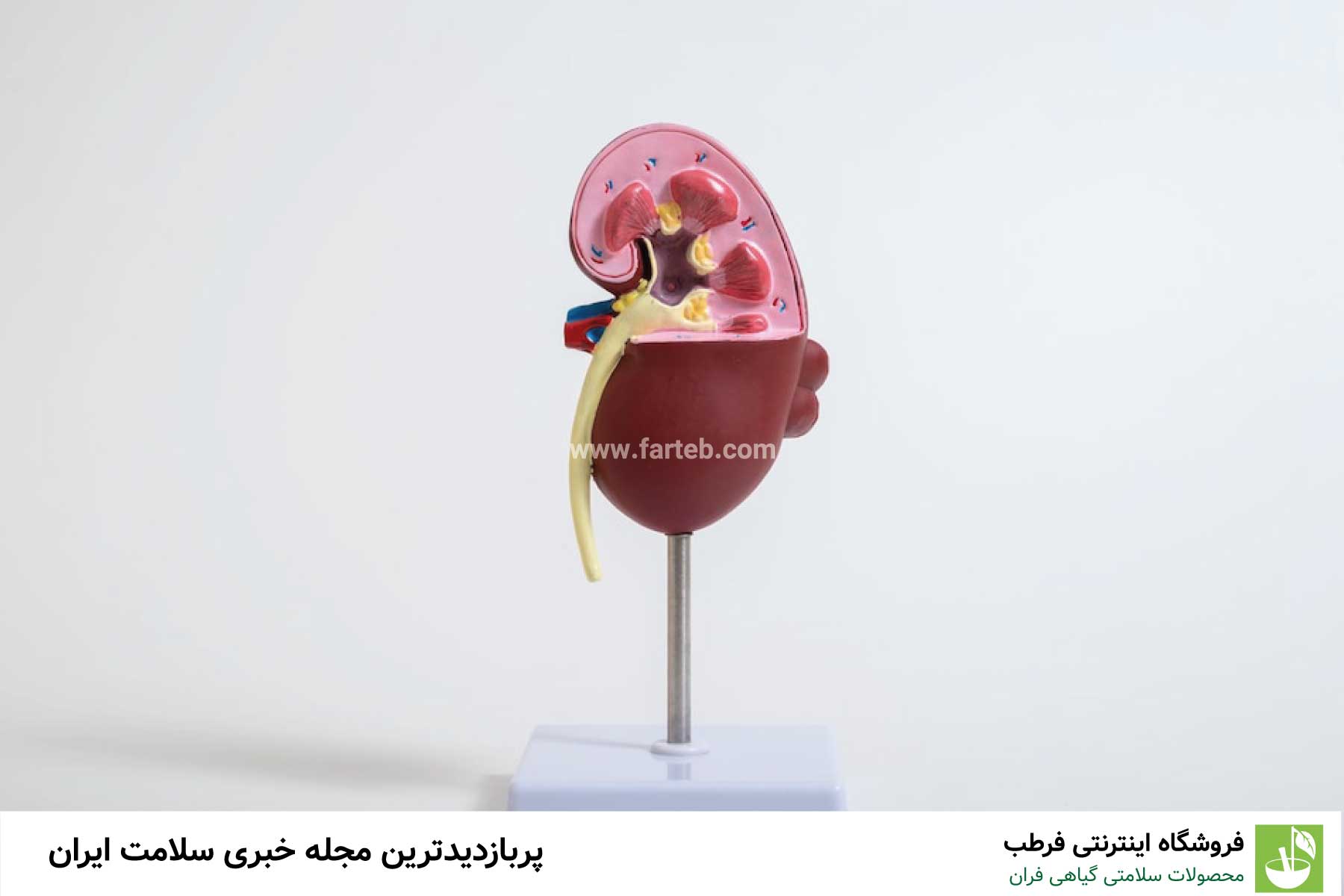 علائم و نشانه های سنگ کلیه
