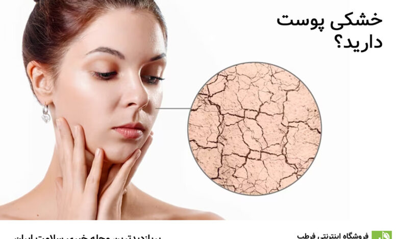 خشکی پوست دارید؟