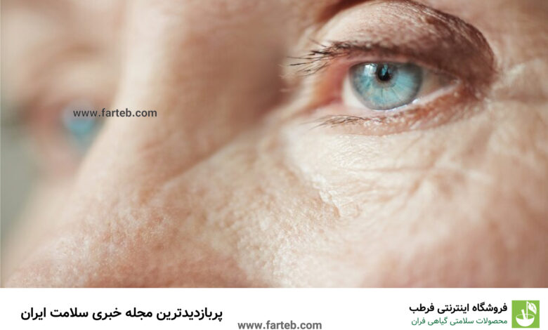 آنچه باید در مورد پیر شدن چشم‌ ها بدانیم