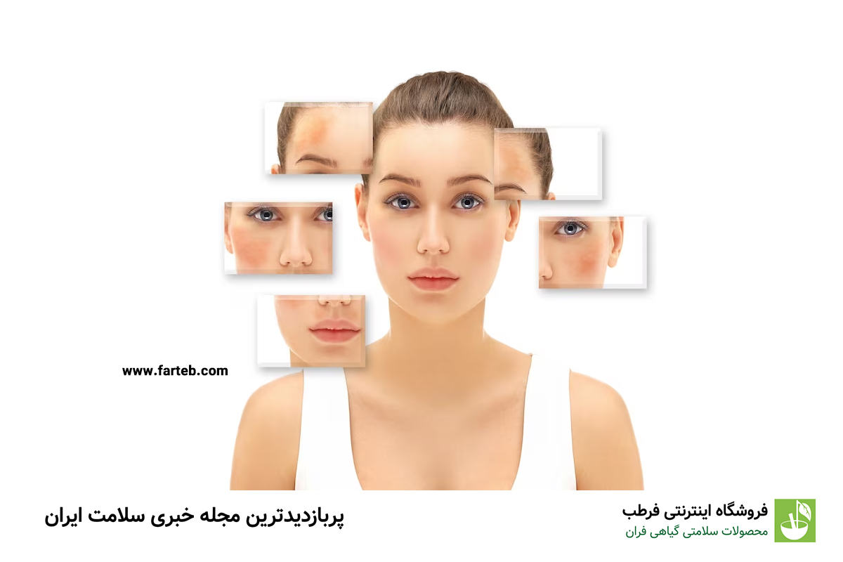 انواع لک صورت