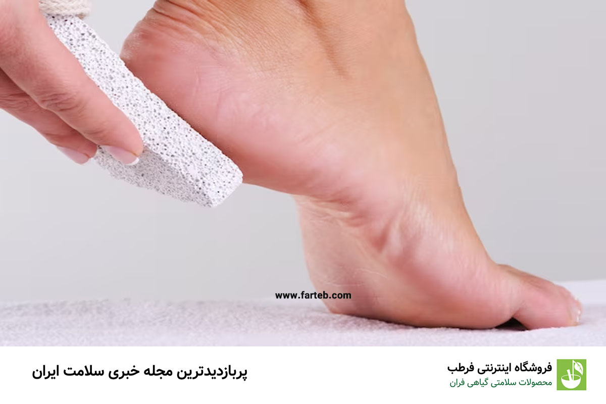 دلایل ترک پاشنه پا و جلوگیری ازآن