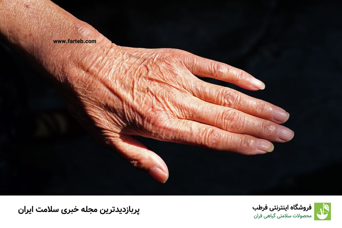بهترین روش برای جلوگیری از شل شدن پوست
