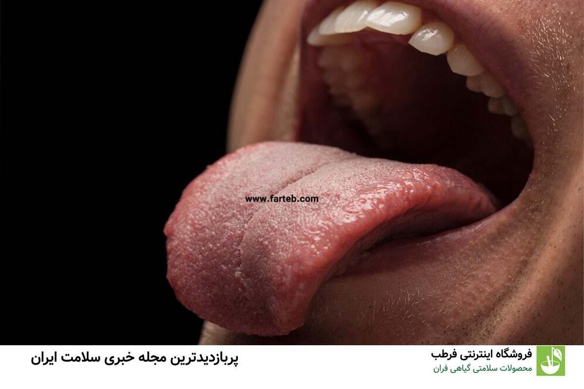 چرا زبان سفید میشود؟ درک علل و تفسیر نشانهها
