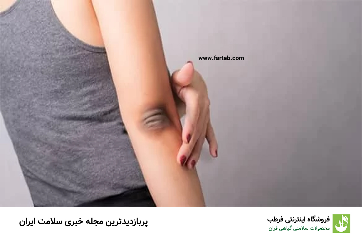 راهنمای کامل برای درمان تیرگی پوست زانو و آرنج: روشها و تکنیکهای اثبات شده
