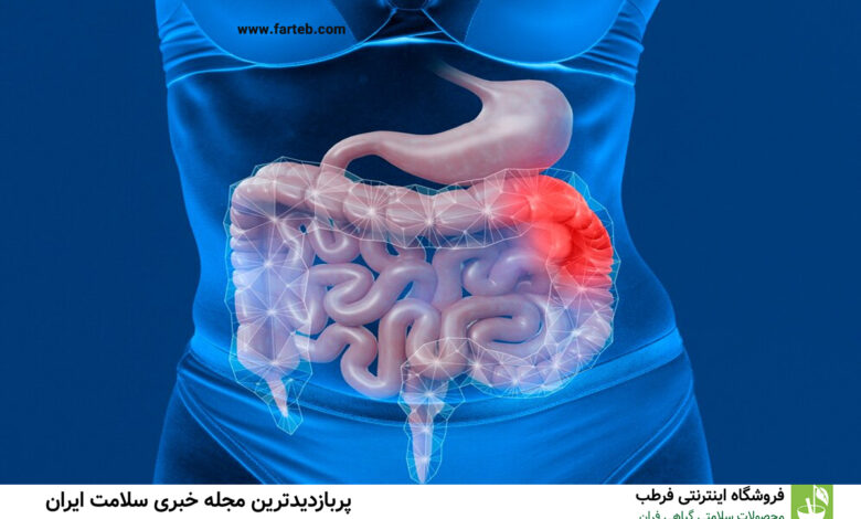۵ ماده غذایی فوق‌العاده برای تقویت سلامت روده: رازی برای بهبود هضم