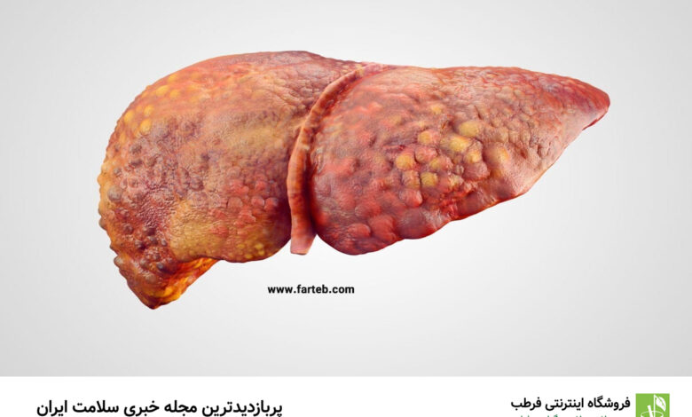 چگونه بفهمیم کبدمان مشکل دارد؟ علائم هشدار دهنده ناراحتی کبد