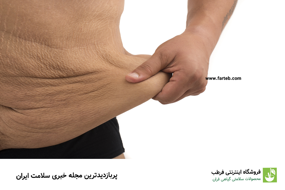 چطور هم وزن کم کنیم و هم از افتادگی پوست جلوگیری کنیم؟