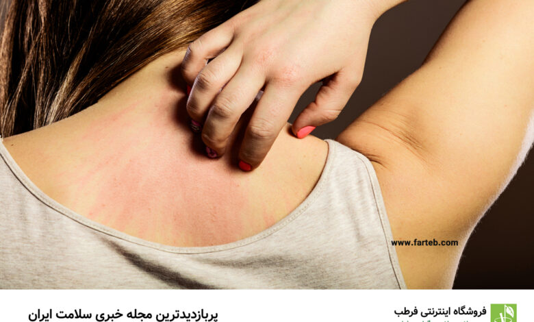 راهنمای جامع آلرژیهای پوستی: علل، روشهای تشخیص و بهترین روشهای درمان