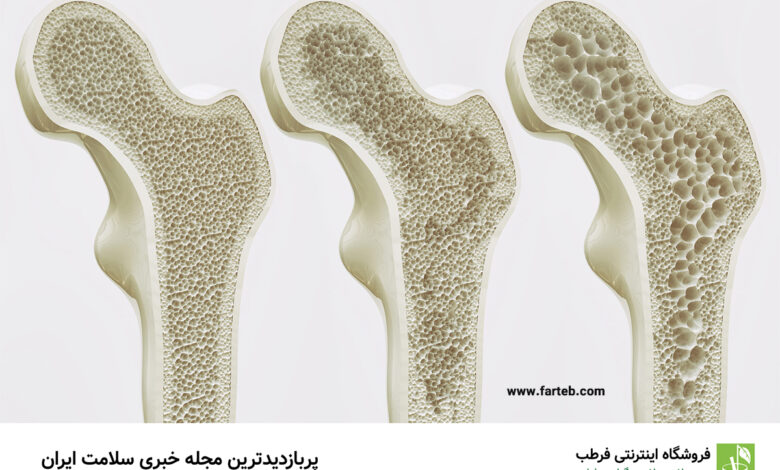 برای تقویت و سلامت استخوان‌ها، این میوه شگفت‌انگیز را مصرف کنید!