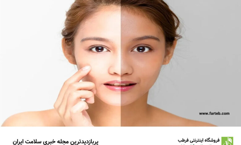 کدام ویتامین‌ها به روشن‌شدن پوست صورت کمک می‌کنند؟ راهنمای جامع ویتامین‌های موثر برای پوست درخشان