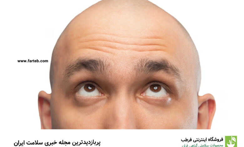 گنجی که فقط کچل‌ها دارند