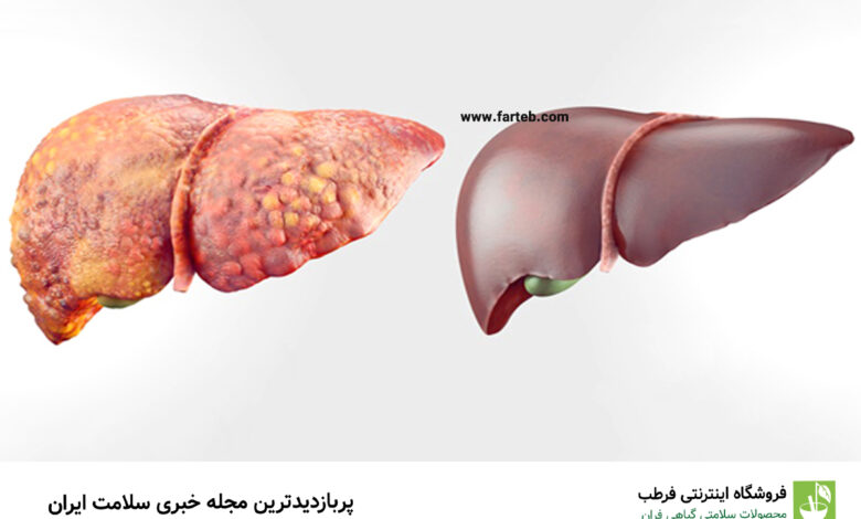سم‌زدایی کبد با نخوردن این خوراکی پرطرفدار!