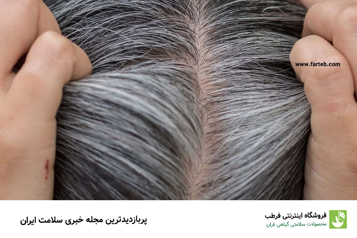 کمبود این ویتامین باعث سفید شدن مو می‌شود