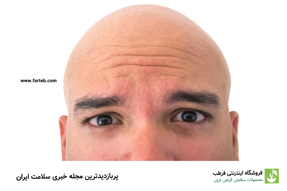 گنجی که فقط کچل‌ها دارند