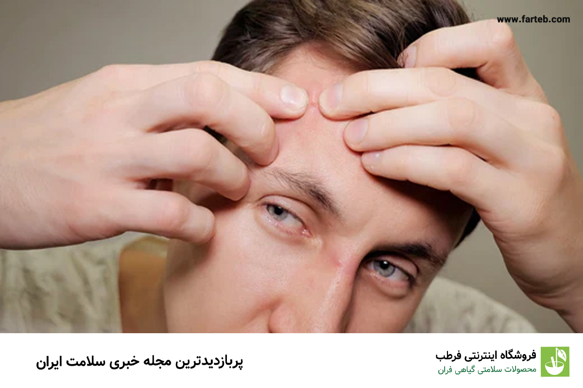 علت جوش پیشانی چیست و چگونه درمان می‌شود؟
