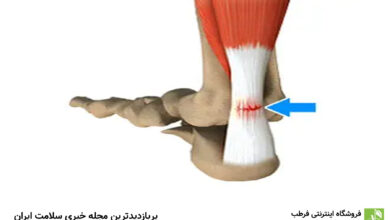 پارگی تاندون چیست و چگونه درمان می شود؟