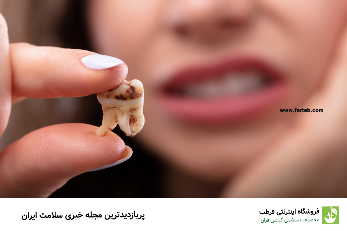 برای جلوگیری از پوسیدگی دندان لب به این غذاها نزنید