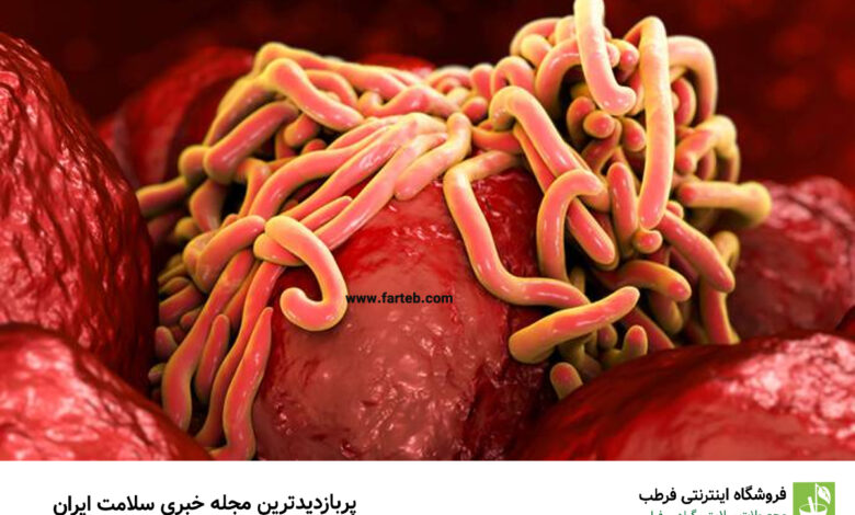 انگل روده دارید؟ با این گیاهان از بین ببرید
