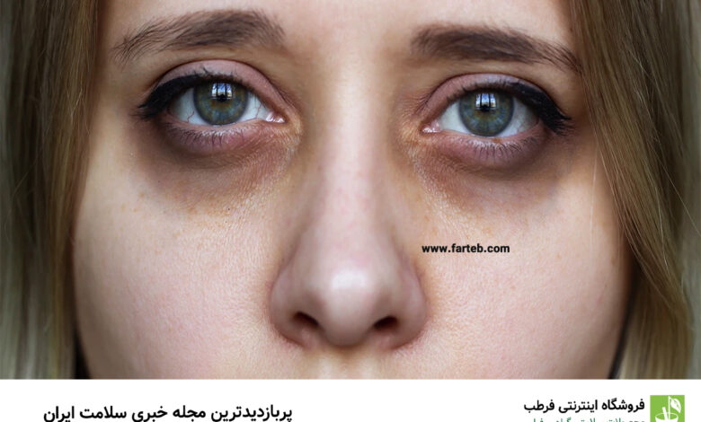 سیاهی دور چشم کمبود چه ویتامینی است؟