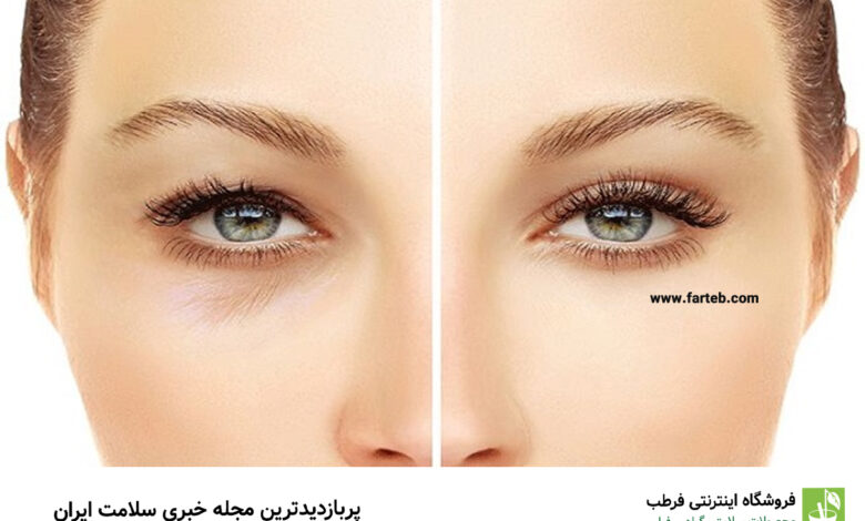 روشی سریع برای مقابله با پف صبحگاهی