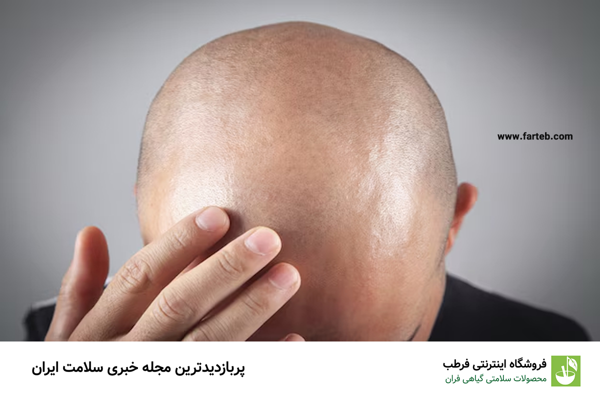 علت طاسی سر چیست؟ آیا راهی برای پیشگیری و درمان طاسی وجود دارد؟