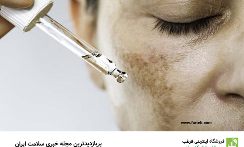 علت تیرگی پوست صورت چیست؟
