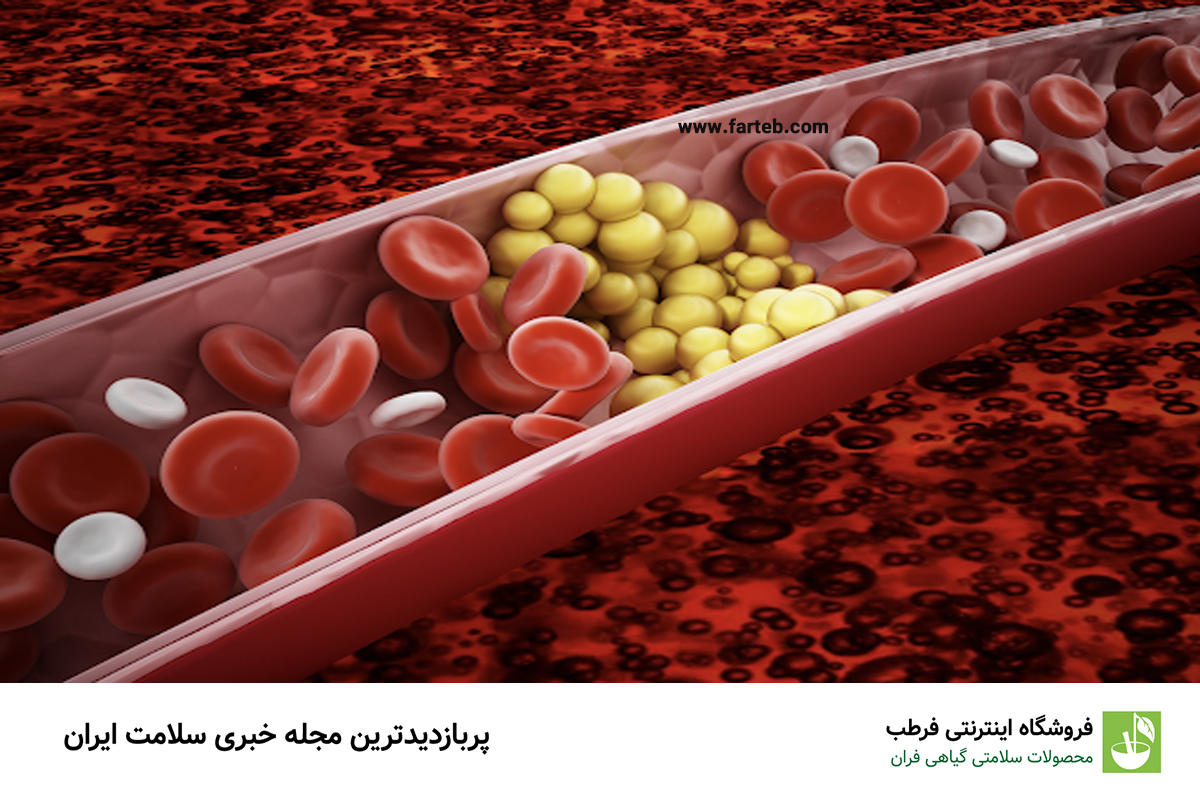 علائم و روش درمان تری گلیسیرید بالا