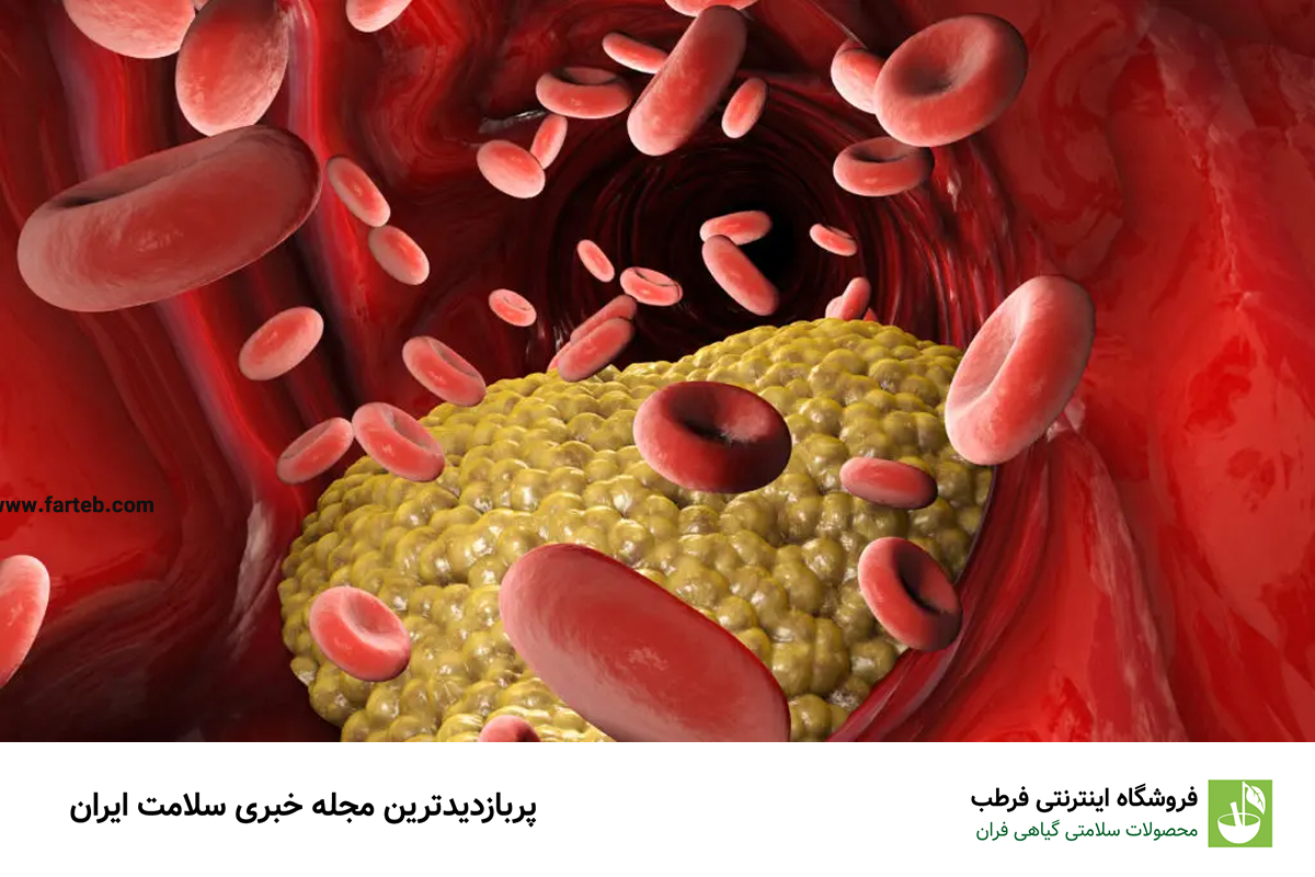 علائم و روش درمان تری گلیسیرید بالا