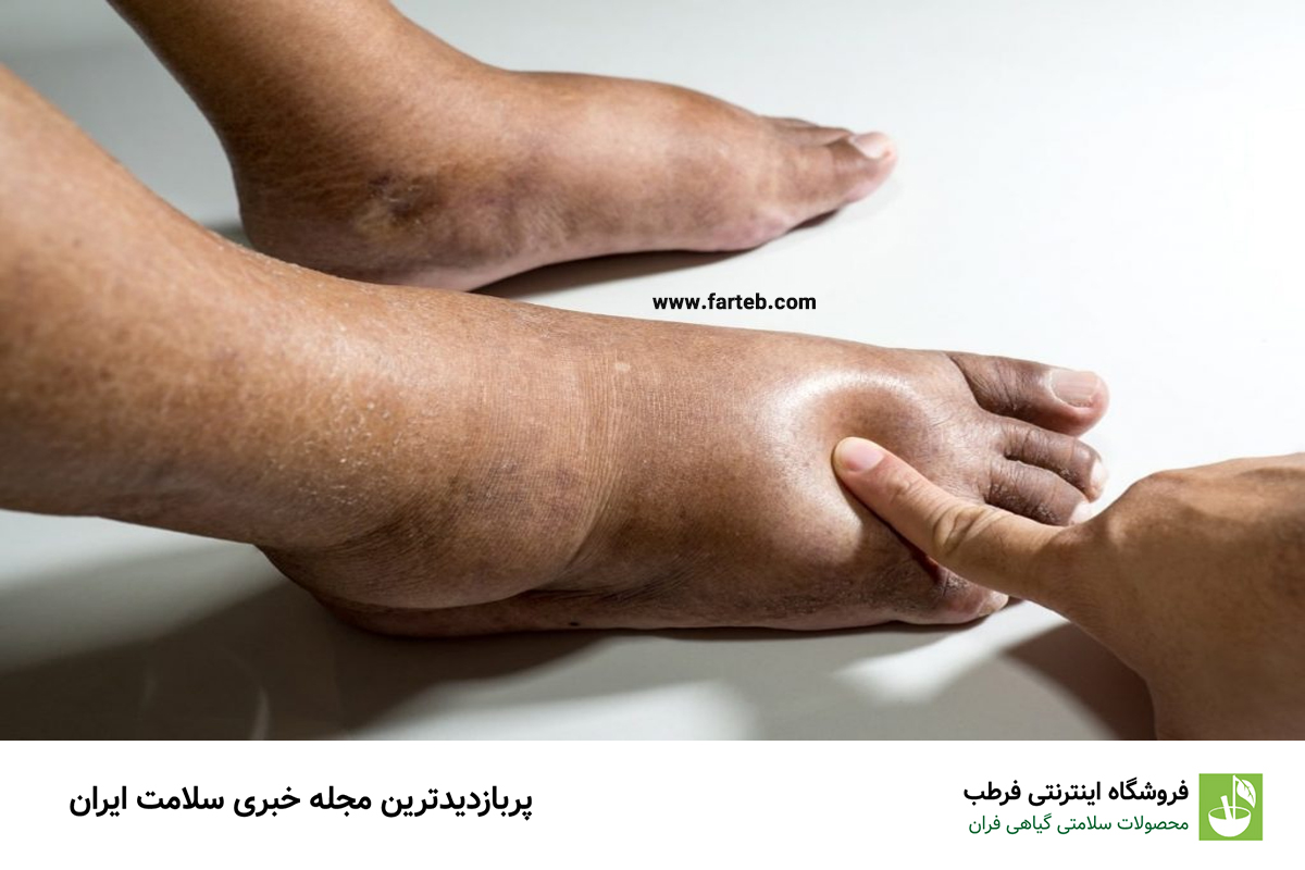 ۳. نوشیدنی‌های مفید برای کاهش ورم پاها
