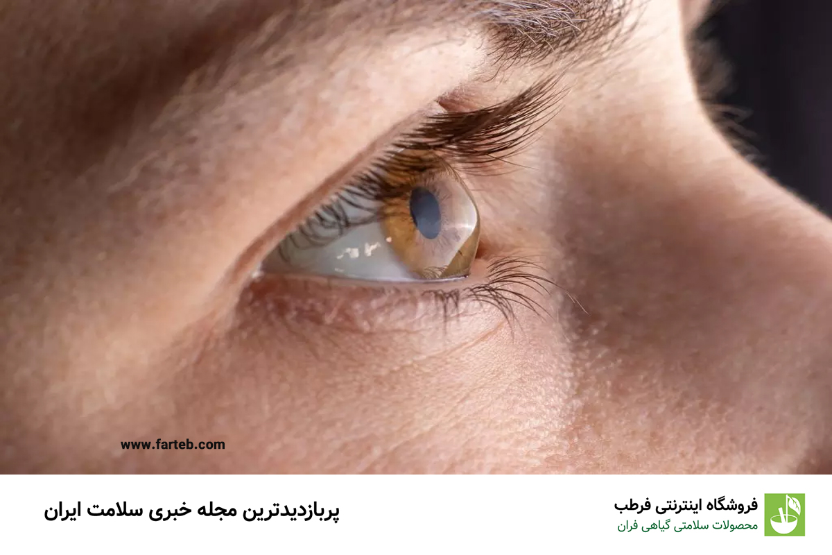 خطرات قوس پیری قرنیه در سنین پایینتر؛ زنگ خطری برای جوانان