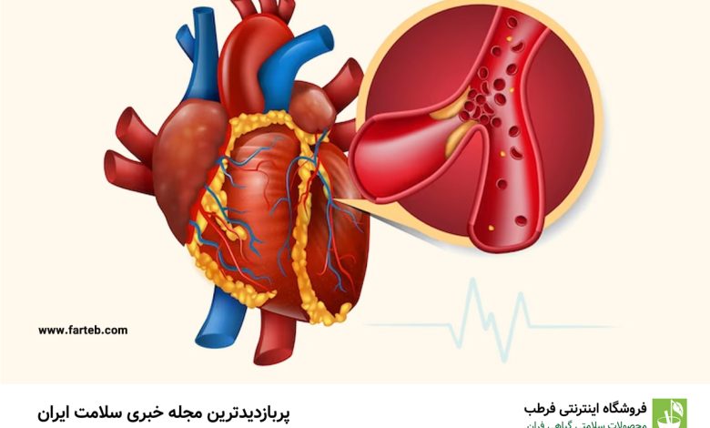 علائم و روش درمان تری گلیسیرید بالا