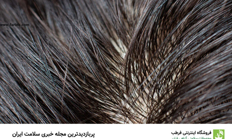 دلیل اصلی چرب شدن موهایتان این غذاهاست !