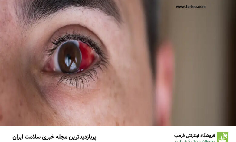 چه غذاهایی فشار چشم را بالا میبرد؟
