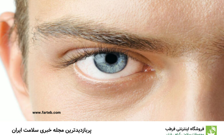 این علامت داخل چشمت، یعنی مشکل قلبی و کلسترول!