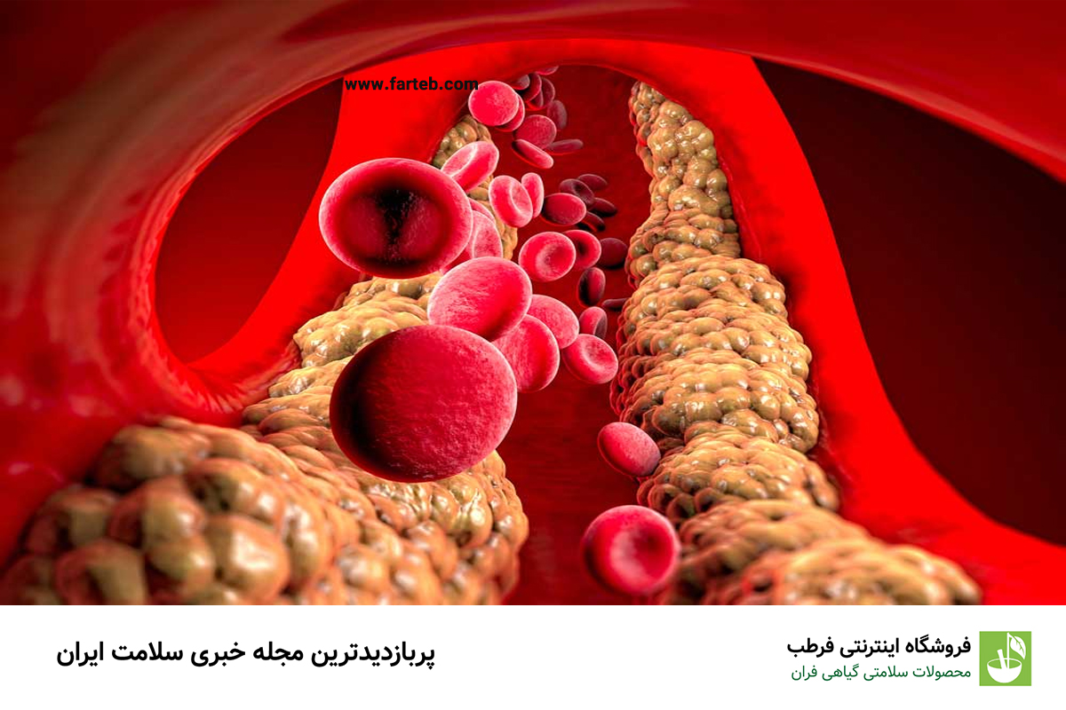 علائم و روش درمان تری گلیسیرید بالا