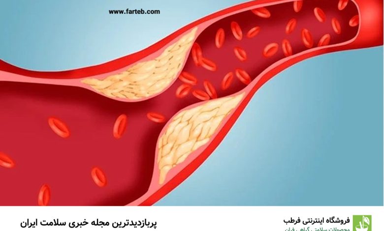 ۱۱ ماده غذایی مفید برای کاهش چربی خون