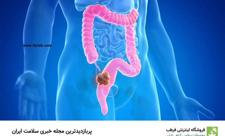 کدام ویتامین باعث کاهش خطر ابتلا به سرطان روده بزرگ می شود؟