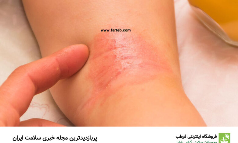 ۸ توصیه طلایی برای این که عرق‌سوز نشوید