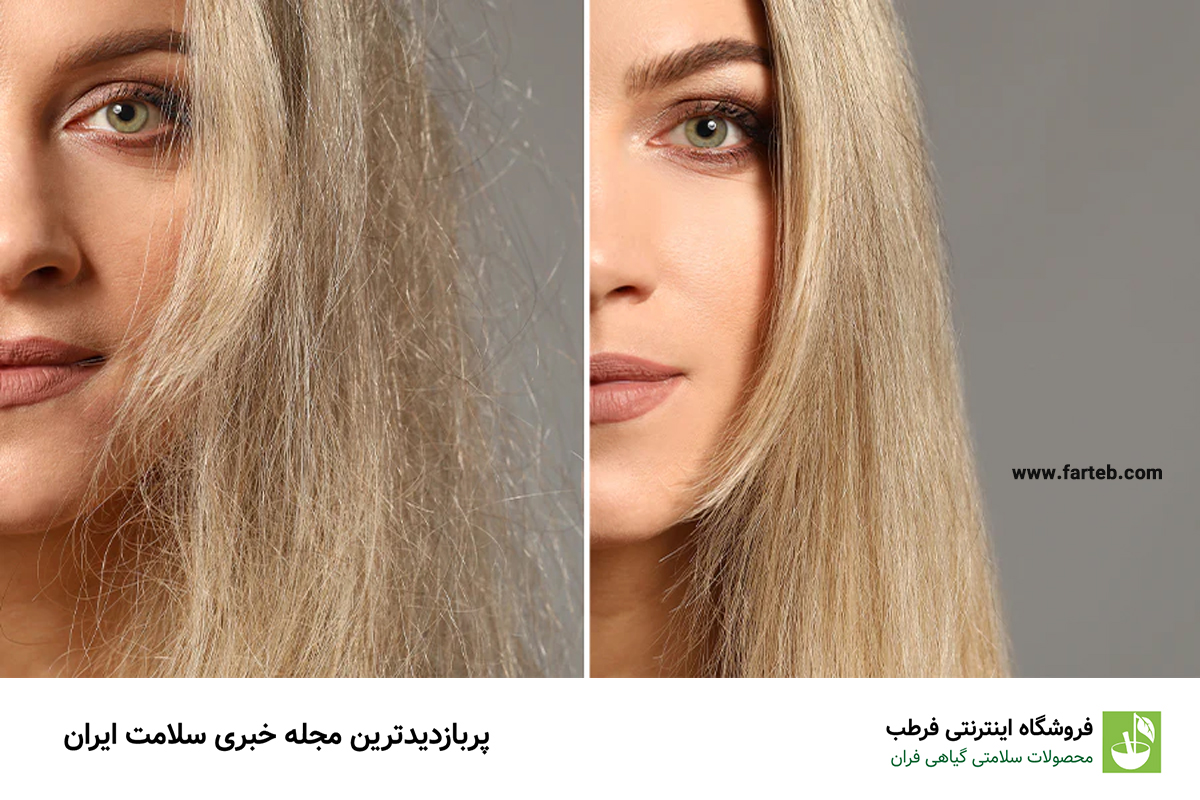 بهترین راهکار ها برای گرفتن وز مو در خانه