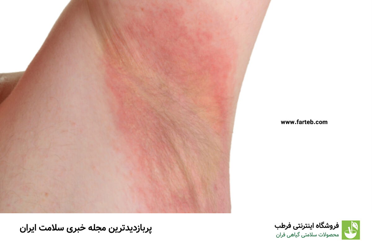 ۸ توصیه طلایی برای این که عرق‌سوز نشوید