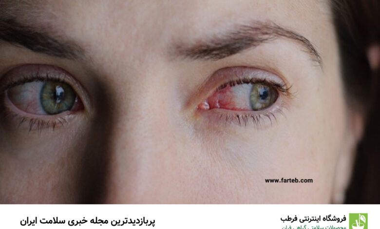 سکته چشمی چیست؟ بررسی علل، علائم و خطر های آن