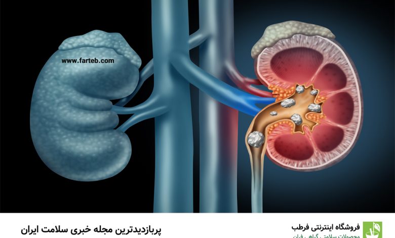 دم‌کرده این سبزی ناشتا سنگ کلیه رو پودر می‌کنه | نابودگر سنگ کلیه کشف شد
