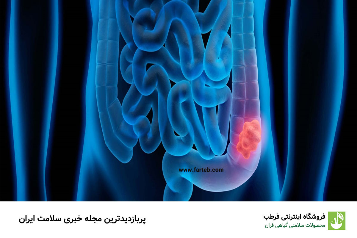کدام ویتامین باعث کاهش خطر ابتلا به سرطان روده بزرگ می شود؟