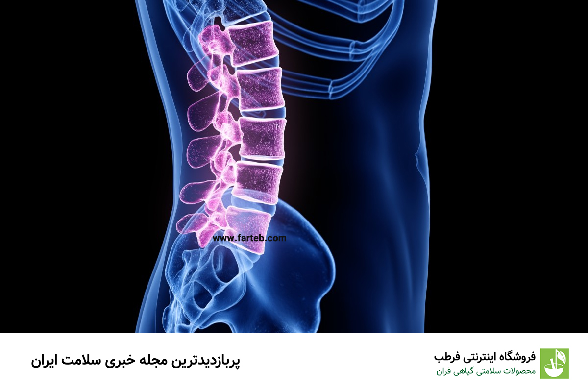 درمان سریع گودی کمر (معرفی ۱۲ روش درمان)