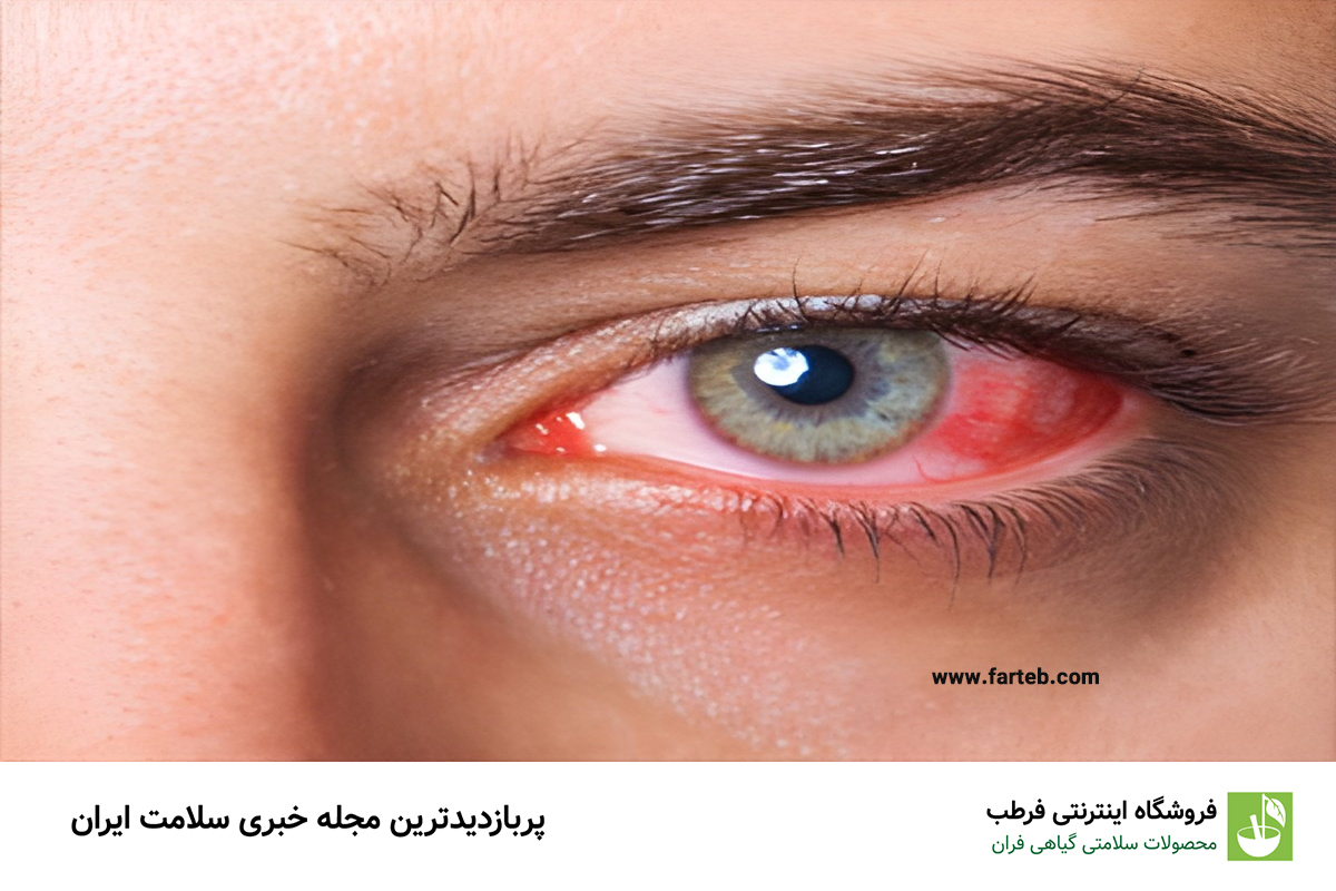 سکته چشمی چیست؟ بررسی علل، علائم و خطر های آن
