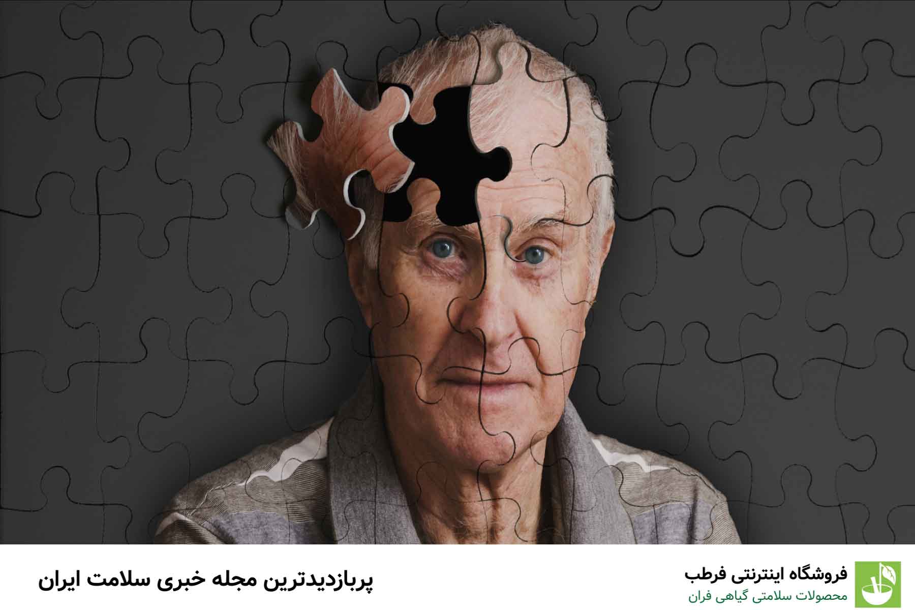 آلزایمر