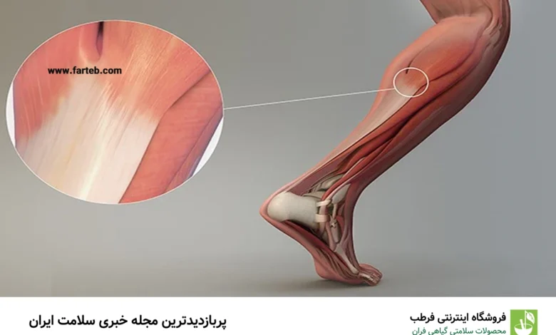 تاندون چیست و چه عملکردی در بدن دارد؟
