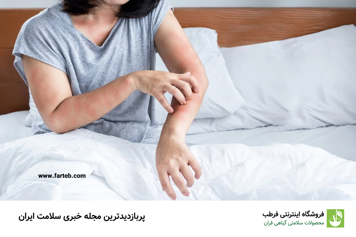 علت خارش بدن در شب و سریعترین راهکار های درمان آن