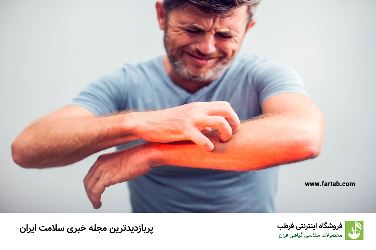 علت خارش بدن در شب و سریعترین راهکار های درمان آن