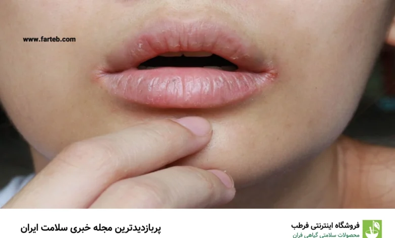 8 نشانه در لب هایتان که سلامتی بدنتان را تهدید میکند